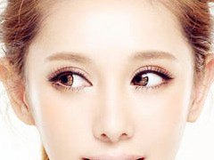 眼睛近视可以做双眼皮手术吗？