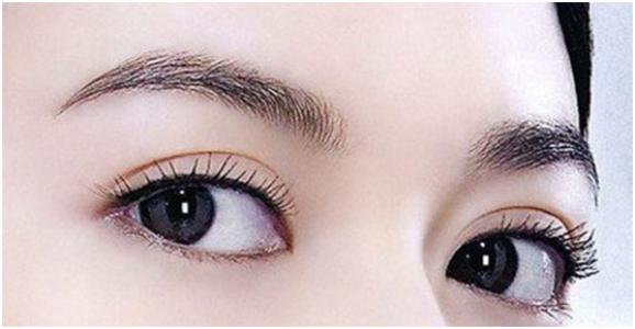 长沙艺星美容医院眼部整形